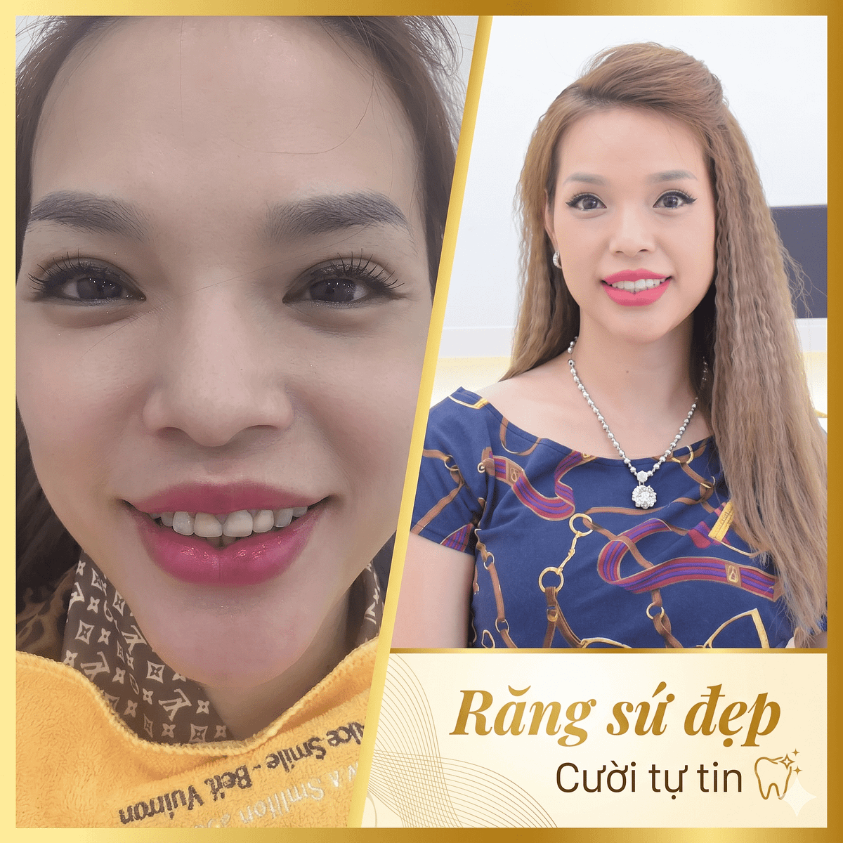 Chị Ngọc Huyền