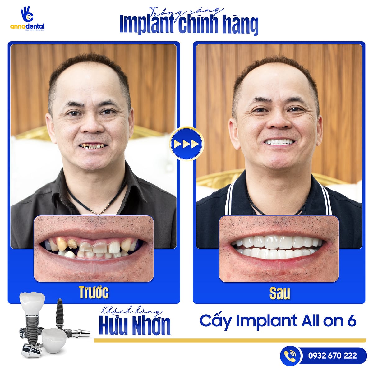 Chú Nguyễn Hữu Nhơn
