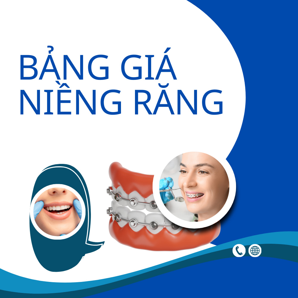 Bảng Giá Niềng Răng Tại Nha Khoa Anna